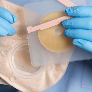 Ostomy and Urological Supplies